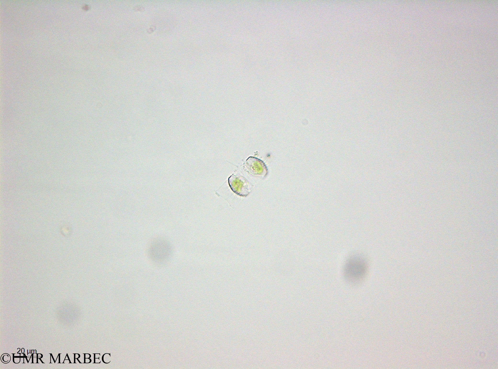 phyto/Thau_Lagoon/THAU_station1/OSU_plancton 2013/Chaetoceros spp (Hypnospores -40x -140110)(copy).jpg